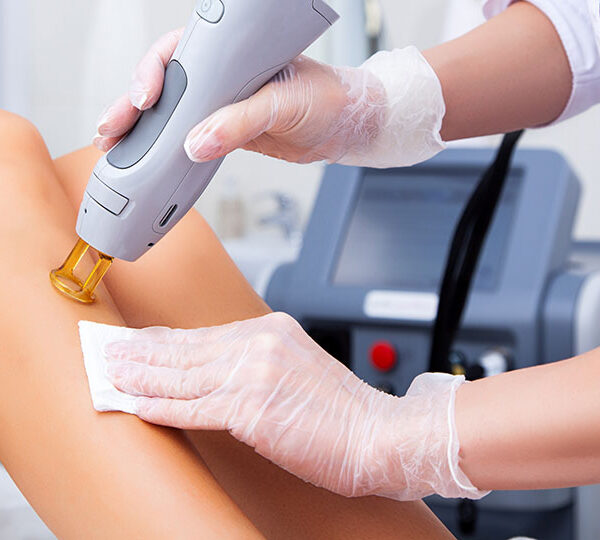 Benefits of getting laser hair removal over waxing